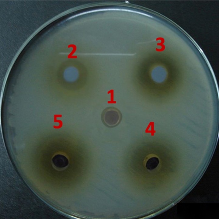 Agar plate of multidrug-resistant Salmonella Typhi showing clear zones of inhibition around the plant-derived discs